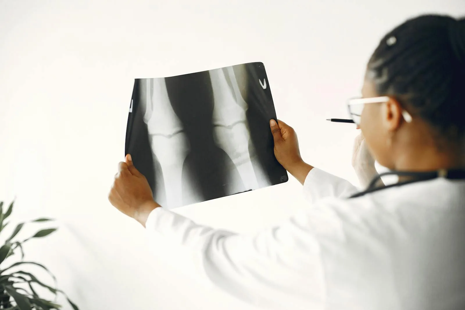 A specialist examining a patient's knee X-ray for orthopedic evaluation